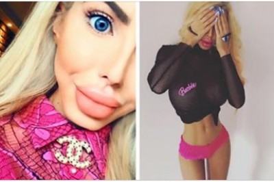 Polska pani architekt postanowiła zostać lalką Barbie! Jej wygląd po operacjach szokuje większość osób! 