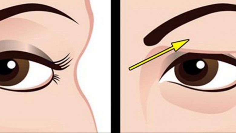 Poznaj prosty sposób na opadające powieki! Dzięki tej naturalnej metodzie unikniesz chirurga plastycznego!