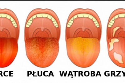 13 rzeczy, które kolor Twojego języka może powiedzieć o Twoim zdrowiu! Obejrzyj go dokładnie w lustrze!