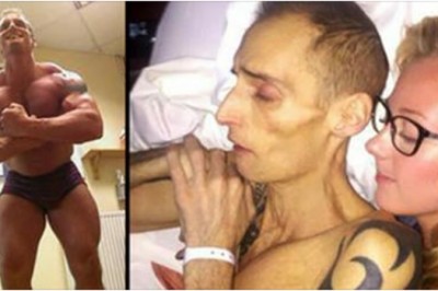 Przyczyna śmierci tego mężczyzny jest przerażająca. Lekarze nie chcieli wierzyć w jego wyjaśnienia.