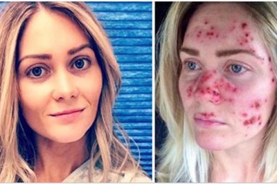 27-latka opublikowała zdjęcie twarzy zupełnie inne niż zawsze! Dotarło ono do setek tysięcy osób!