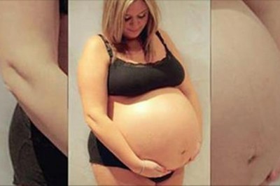 Jej brzuch już w 12 tygodniu ciąży był ogromny i nie przestawał rosnąć! Przytyła ponad 40 kg! 