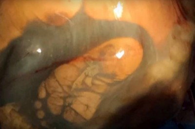  W 41 tygodniu ciąży przychodzi na USG! To, co lekarz odkrywa podczas badań odbiera wszystkim mowę!