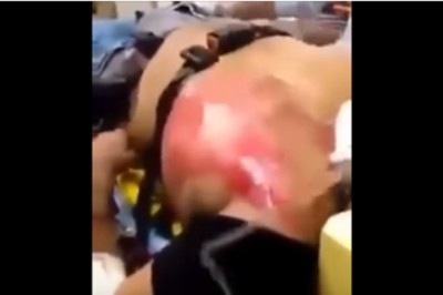 Wypił 24 energetyki przez co trafił do szpitala! Jego serce niemal eksplodowało!