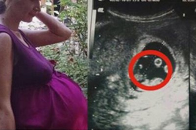 Gdy trafiała na oddział lekarze bali się ją dotknąć! Jej brzuch skrywał prawdziwy fenomen!