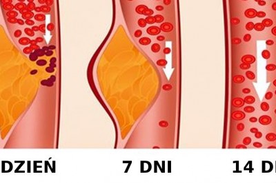 Dowiedz się czym jest dieta DASH i dlaczego tak wielu lekarzy ją poleca! Rezultaty są świetne! 