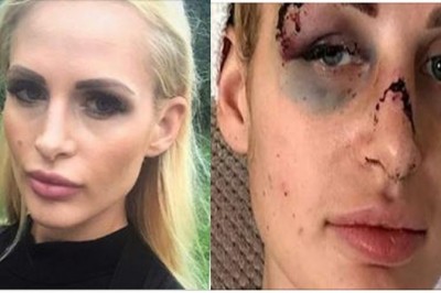 „Zmasakrował mi twarz. Byłam pewna, że mnie zabije”! Popularny trener personalny skatował swoją partnerkę! 