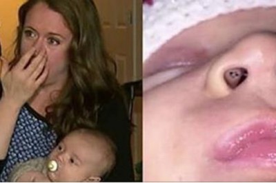 Karmiła piersią dziecko, kiedy zauważyła w jego nosie czarne punkciki! Po chwili połączyła fakty!