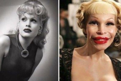 14 gwiazd światowego formatu, które zatraciły się w operacjach plastycznych! Stracili ludzki wygląd! 