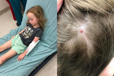 Zdrowa 5-latka nagle doznaje całkowitego paraliżu ciała! Przeczesując jej włosy znajduje coś nietypowego! 