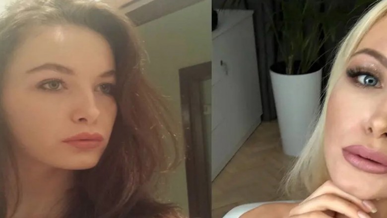 Roxi Gąska od pięknej naturalnej dziewczyny do „żywej Barbie” Tak zmieniała się nowa partnerka Rozenka! 