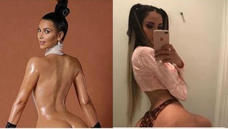 Ta kobieta wstrzyknęła w pośladki 2 litry tłuszczu, żeby mieć pupę jak Kim Kardashian! Rachunek 240 tys!