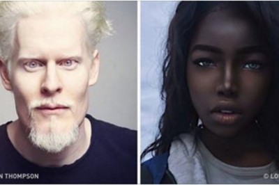 8 osób, których unikalny kolor skóry podbił świat! Ich uroda oczarowała tysiące ludzi!