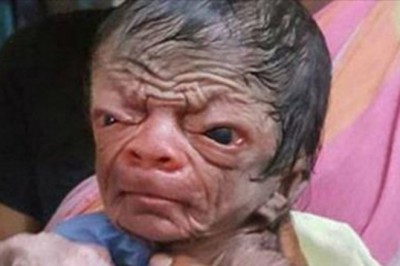 Mama ze strachem spogląda na twarz nowo narodzonego dziecka! Mimo diagnozy miłość zwycięża!