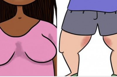 30 nieprzyjemnych sytuacji, które są Twoją zmora każdego lata! Mało kto głośno o tym powie!