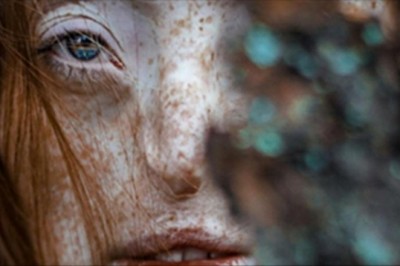 Jak miała 16 lat musiała przejść ciężką operację! Zdjęcie jej niemal nagiego ciała odbiera mowę!