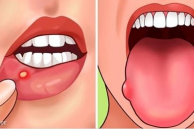 7 znaków świadczących o tym, że twój organizm ma braki kwasu foliowego. Zobacz jak je uzupełnić.