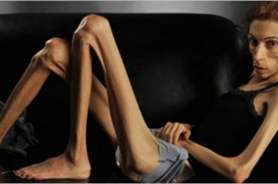 Ważyła jedynie 20 kg i była na skraju śmierci. Dzięki pomocy ludzi zaczęła się zmieniać 