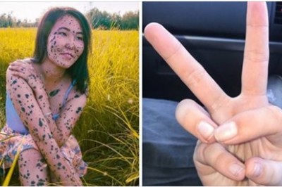 20 osób, które wyglądają tak unikatowo, że prawdopodobnie pochodzą z innej planety. Są wyjątkowi i piękni 