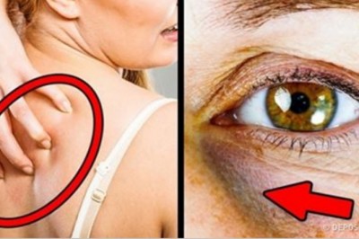 12 objawów sygnalizujących, że spożywasz za dużo cukru. To może być niebezpieczne dla zdrowia