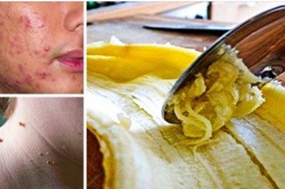 8 powszechnych błędów podczas pielęgnacji skóry, które szkodzą twojej twarzy. Możesz zrobić więcej szkody niż pożytku 