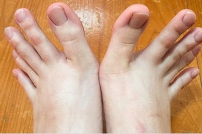 Ludzie dzielą się zdjęciami swoich niezwykłych cech fizycznych, a internet jest w szoku.