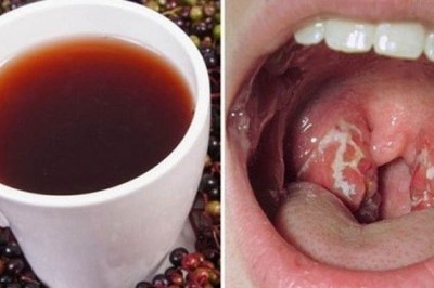 Jak pozbyć się bolesnej infekcji gardła w kilka godzin? Zobacz ten naturalny, szybki sposób 