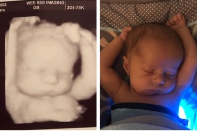 Kilka dni po porodzie mama ogląda zdjęcia z USG i dostrzega coś czego nikt nie zauważył wcześniej 