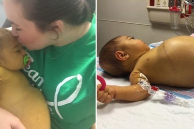 Jej brzuch od urodzenia nie przestaje rosnąć. Gdy lekarze zrozumieli co się dzieje, wpadli w panikę