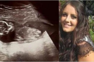 Kiedy pojawiła się w szpitalu kilka dni po aborcji lekarze nie mogli uwierzyć w to co zobaczyli na USG