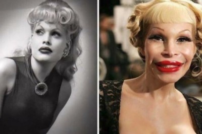 16 gwiazd światowego formatu, które zatraciły się w operacjach plastycznych. Stracili ludzki wygląd