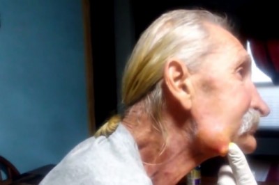 Siostrzenica musiała wycisnąć mu ogromny torbiel na brodzie, bo nie miał ubezpieczenia. Zrobiło mi się słabo