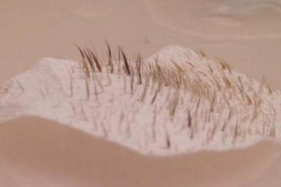 Nie powiesz tego nikomu ale obejrzysz to z przyjemnością. Zdjęcia plastrów na wągry tuż po użyciu