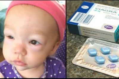 Rodzice podali maleńkiej córeczce viagrę. Wszystko na zalecenie lekarza by ratować jej życie