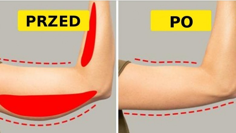 6 prostych ćwiczeń, które pomogą Ci się pozbyć obwisłych ramion. Zobacz jak odzyskać jędrną skórę 