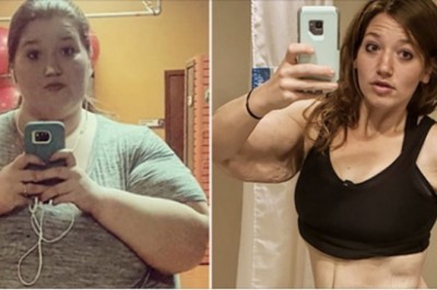 Udało jej się schudnąć 122 kilo. Jej skóra zaczęła wyglądać fatalnie