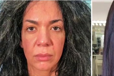 Zdjęcia idealnie pokazujące, że nie potrzebujesz operacji plastycznej by wyglądać zjawiskowo