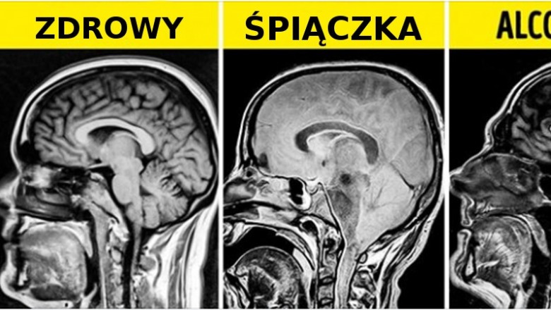 16 zdjęć rentgenowskich, które powiedzą o ludzkim ciele więcej niż książki do anatomii 