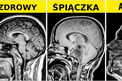 16 zdjęć rentgenowskich, które powiedzą o ludzkim ciele więcej niż książki do anatomii 