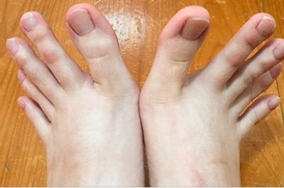 Ludzie dzielą się zdjęciami swoich niezwykłych cech fizycznych, a komentujący nie mogą uwierzyć 