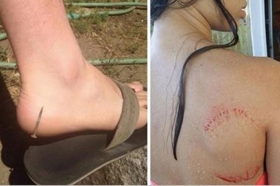 19 sytuacji w których ludzie cudem uniknęli nieszczęścia. Było dosłownie o włos 