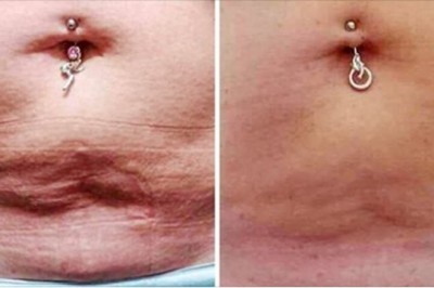 8 efektywnych sposobów na pozbycie się tłuszczu i ukształtowanie mięśni brzucha. Możesz to osiągnąć