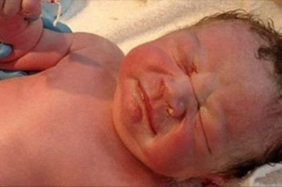 Nie miał prawa się urodzić, a dowód na to trzymał w zaciśniętej piąstce 