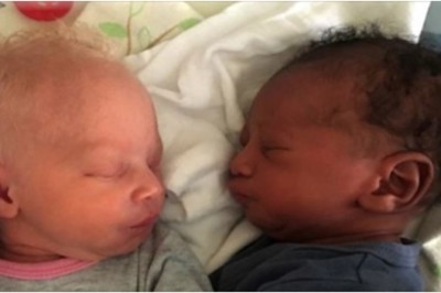 W łódzkim szpitalu urodziły się bliźniaki o różnym kolorze skóry. „To prawdziwa rzadkość”