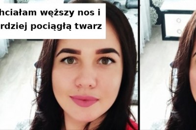 14 przykładów na to, jak operacja plastyczna może odmienić oblicze człowieka