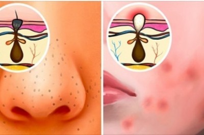 Oto 6 najczęstszych zmian skórnych i co może je wywołać