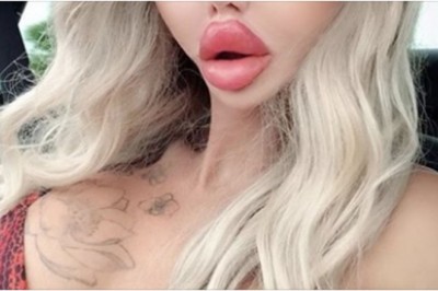 Przez wypełniacze i zabiegi przestała wyglądać jak człowiek. Jej twarz zapamiętasz na długo