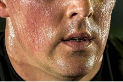 8 objawów świadczących, że twój organizm potrzebuje witaminy D. Nie lekceważ ich