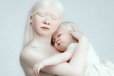 Niezwykłe siostry z albinizmem oczarowały cały świat swoimi zdjęciami. Wyglądają magicznie 