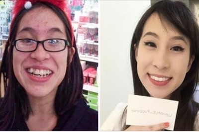 Jako nastolatki nie znosiły swojego wyglądu, dorastając zmieniły się nie do poznania